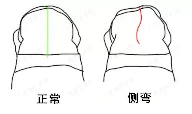 【国家级培训课程】2024年国家体育总局青少年脊柱侧弯体态干预师培训通知(图1)